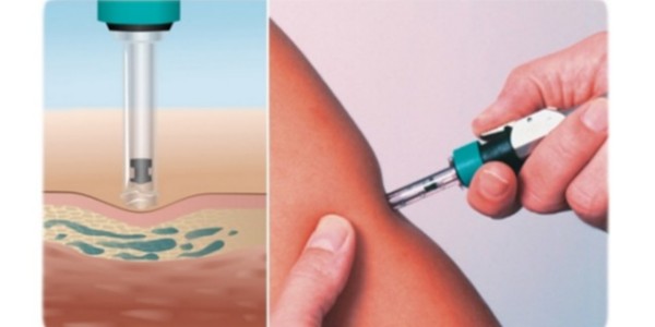 你知道無針注射器的工作原理嗎