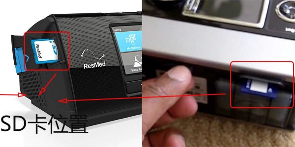 為什么說家用呼吸機(jī)售后很重要