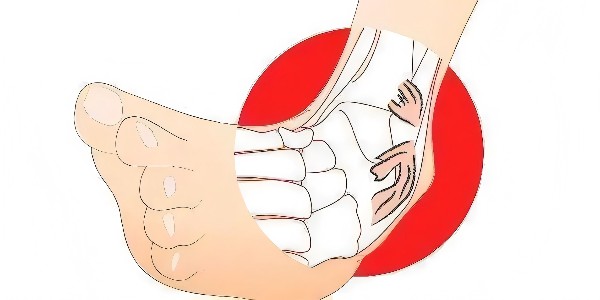 踝關(guān)節(jié)扭傷后的最佳應(yīng)對(duì)指南：簡(jiǎn)單四步，助力快速康復(fù)！