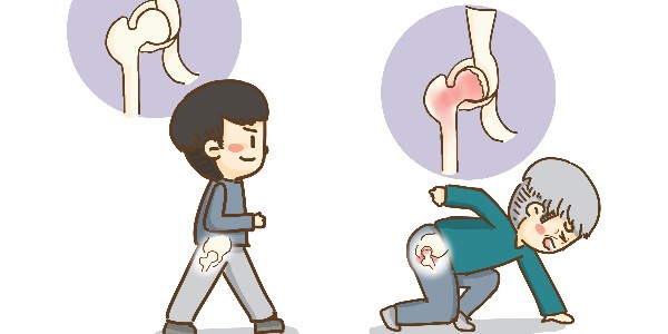 股骨骨折如何使用紗布繃帶包扎