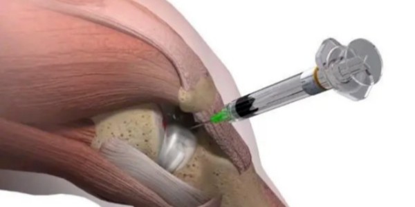 用注射器打完封閉針多久可以洗澡