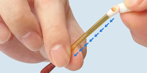 碘伏棉棒：一種常見(jiàn)的醫(yī)療消毒工具